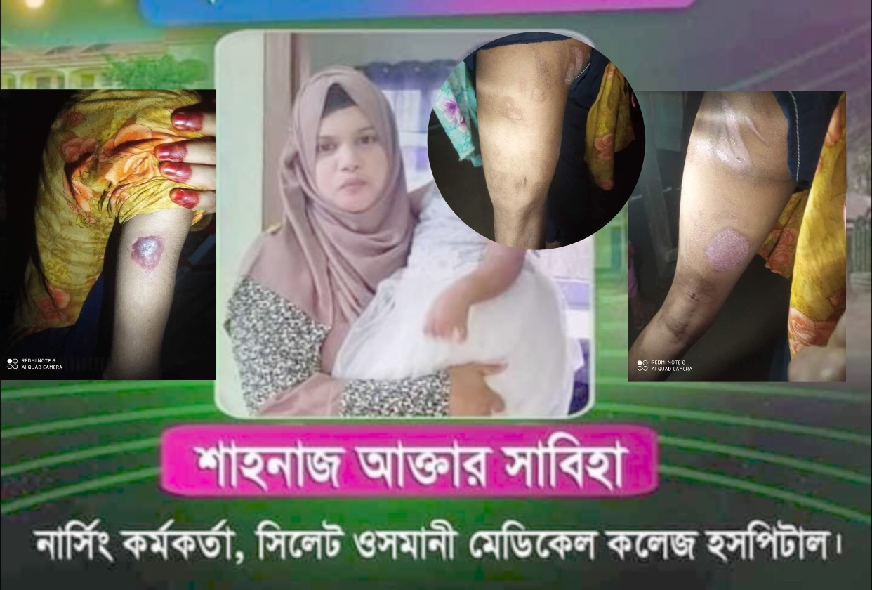 ওসমানী মেডিকেলের নার্সের বাসায় গৃহপরিচারিকাকে নির্যাতনের অভিযোগ