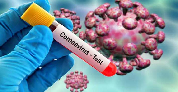 একদিনে ১৮ জনকে পরীক্ষা করে ৬ জনের শরীরে মিলল ক রো না