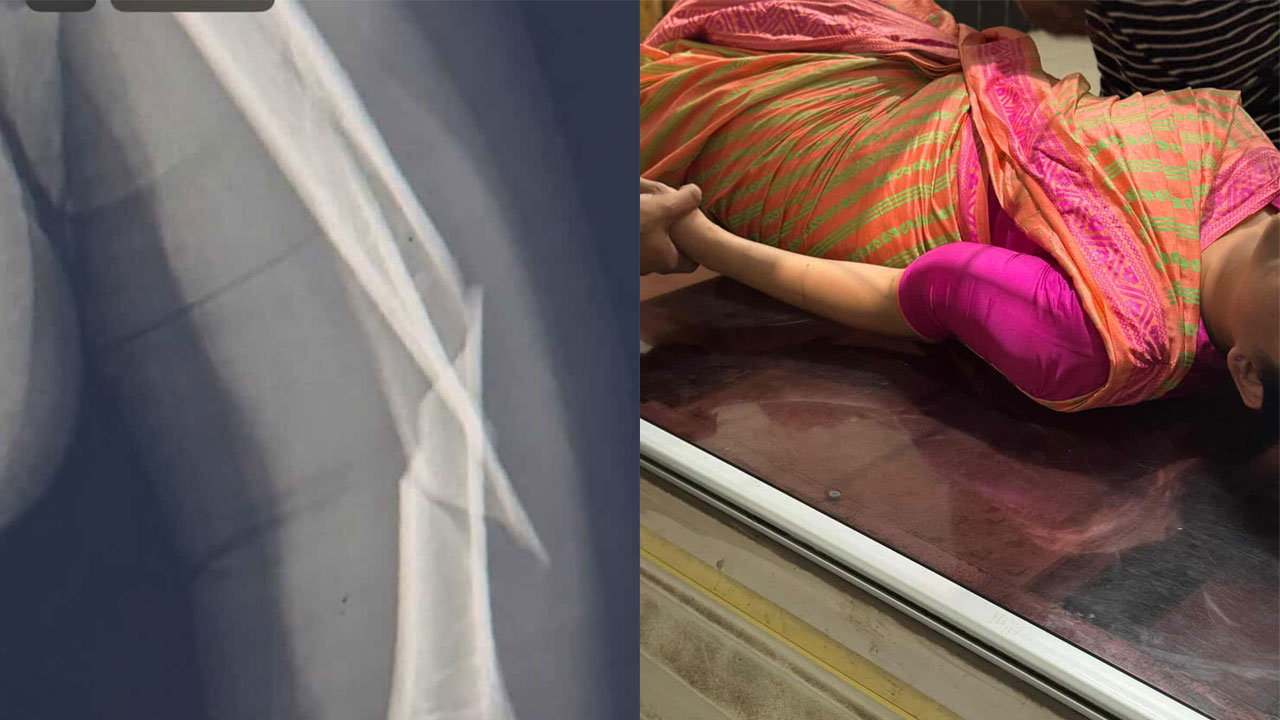মাঝ আকাশে হাত ভা ঙ লো বিমানের কেবিন ক্রুর