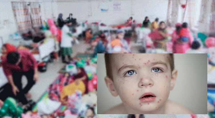 সিলেটে হামের প্রকো*প:  আরও দুই শিশুর মৃ*ত্যু,