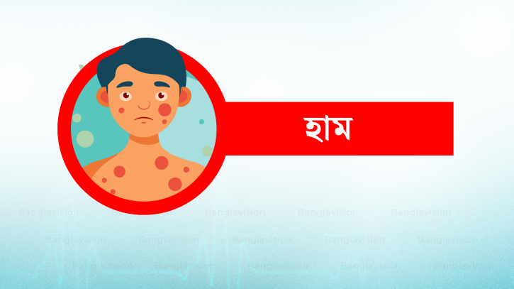 সিলেটে ২৪ ঘণ্টায় দুই শিশুর মৃ'ত্যু, হাসপাতালে ১৫৮ জন