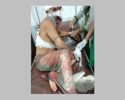 বড়লেখায় ব্যবসায়ীর উপর হামলা, গ্রেপ্তার হয়নি মূল আসামীরা