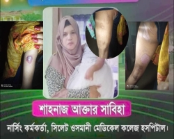 ওসমানী মেডিকেলের নার্সের বাসায় গৃহপরিচারিকাকে নির্যাতনের অভিযোগ