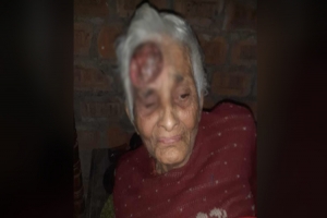 অর্থাভাবে টিউমারের চিকিৎসা করাতে পারছেন না জগন্নাথপুরের রশিদা 